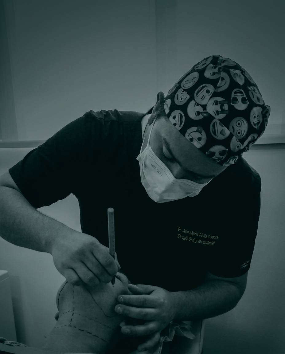 Dr. Juan Alberto Dávila realizando marcaje facial preoperatorio